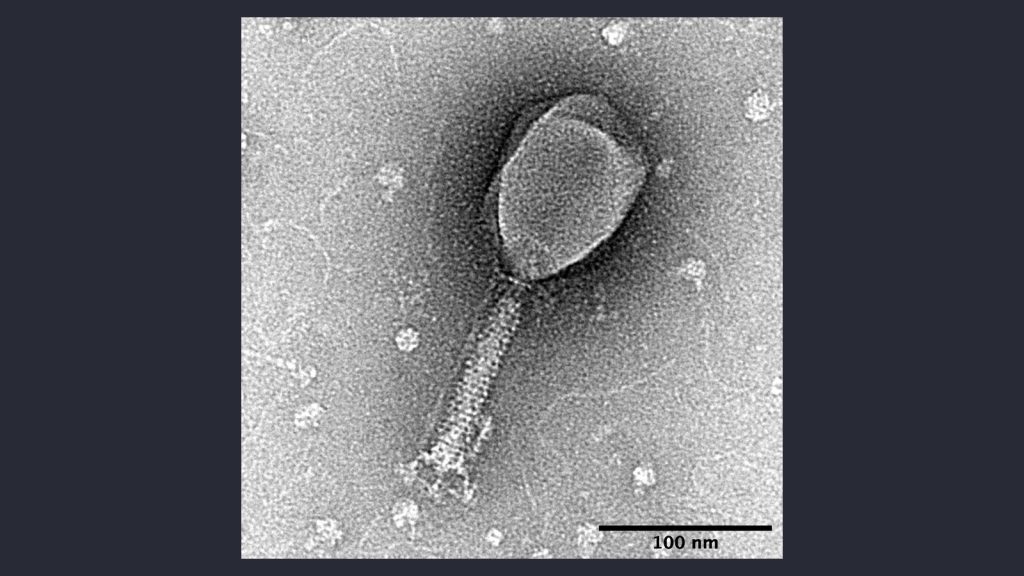 Micrografía electrónica de un bacteriófago T2, con su cápside y su cola visibles
