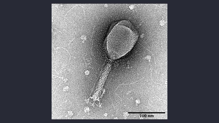 Micrografía electrónica de un bacteriófago T2, con su cápside y su cola visibles